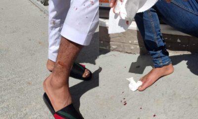 Επίθεση αδέσποτων σε πολίτες στο Λάππα- Τραυματίστηκαν στα χέρια και στα πόδια