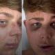 Ο 18χρονος Βρετανός τουρίστας αποκαλύπτει λεπτομέρειες για τον ξυλοδαρμό στον Λαγανά της Ζακύνθου