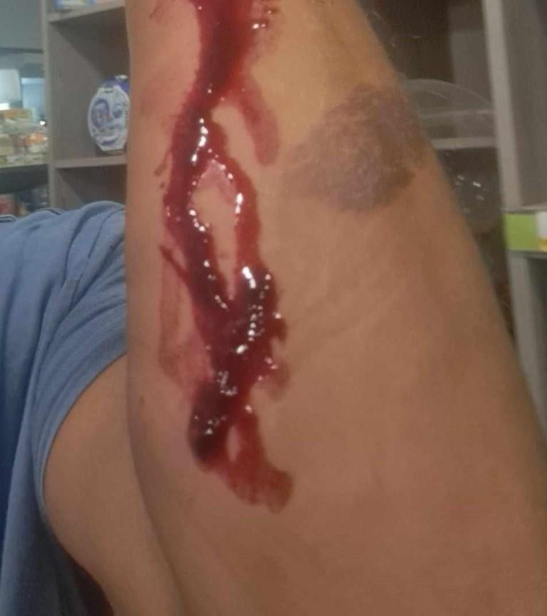 ΠΑΤΡΑ: Επίθεση με μαχαίρι από ανήλικους ρομά σε 33χρονο - Ανησυχία για την αύξηση της βίας και αντιπράξεις