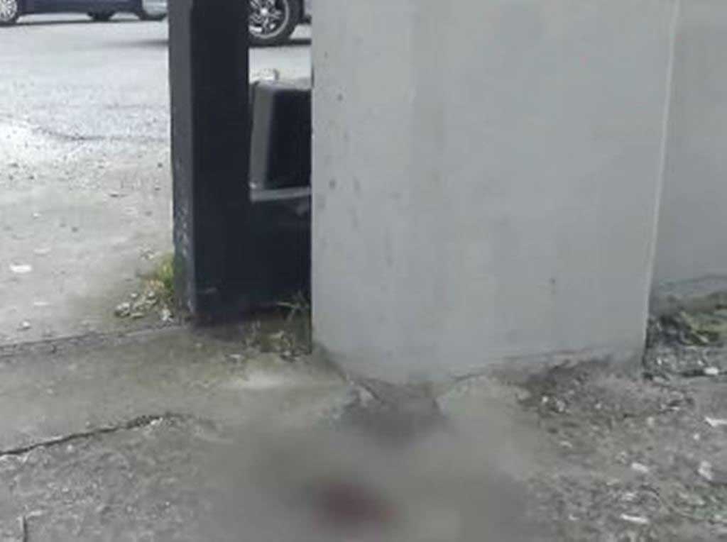 Βίντεο ντοκουμέντο - Άγρια επίθεση με μαχαίρι: Γυναίκα επιβίωσε και ζήτησε βοήθεια από συναδέλφους