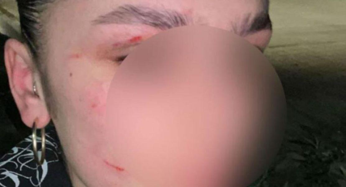 φυλάκιση, αναστολή, 18χρονη, μαθήτρια, ΕΠΑΛ, Πάτρα, επίθεση, συμμαθήτρια, τάξη, μήνυση, Εισαγγελέας, σύλληψη, δικαστήριο, αυτόφωρο, bullying, απειλές, αστυνομία, δίκη, εξωσχολικοί