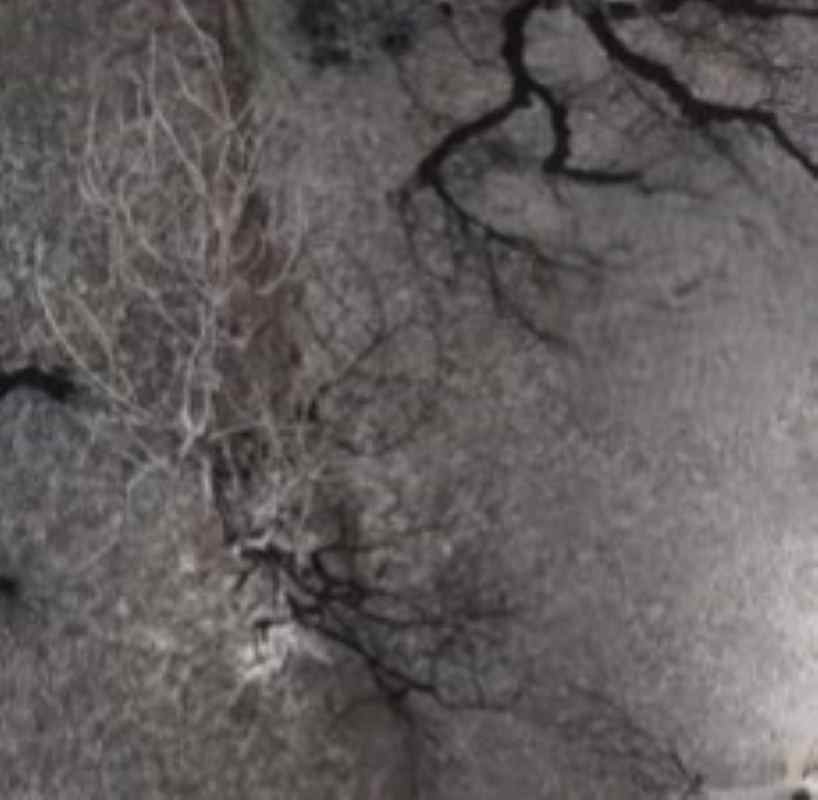 Πάτρα, Δυτική Αχαΐα, πυρκαγιές, καταστροφή, επιχειρήσεις, καλλιέργειες, ελαιόδασος, Μποζαΐτικα, Παναγιώτης Καζούρας, ζημιές, στάχτη, οικονομικές απώλειες, αποζημιώσεις, τοπική οικονομία, ισχυροί άνεμοι, υψηλές θερμοκρασίες, κατάσβεση, πλήγμα, αγρότες, περιβάλλον