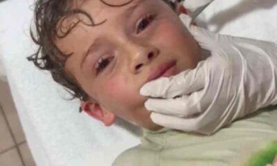 μικρό καβούρι αυτί παιδιού, crab in child’s ear, Μεξικό παραλία περιστατικό, Mexico beach incident, Κίτζια Μίτρε influencer, Kitzia Mitre influencer, Πέδρο παιδί Μεξικό, Pedro child Mexico, ζωντανό καβούρι στο αυτί, live crab in ear, αφαίρεση καβουριού γιατροί, doctors remove crab, ιατρικό κέντρο παραλία, beach medical center, παράξενο περιστατικό παραλία, strange beach incident, viral βίντεο καβούρι αυτί, viral video crab ear, κινδυνοι παραλία παιδιά, beach dangers children, σπάνιο ιατρικό περιστατικό,