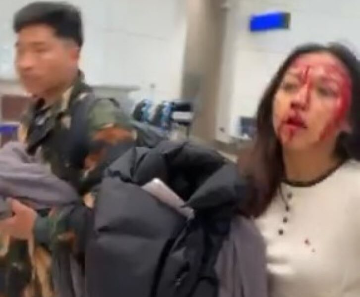 επίθεση Ντουμπάι, Dubai attack, αεροδρόμιο Ντουμπάι εκκένωση, Dubai airport evacuation, Ιράν επίθεση Κόλπος, Iran attack Gulf states, αεροδρόμιο DXB νέα, DXB airport news, έκτακτη επικαιρότητα Μέση Ανατολή, Middle East breaking news, εκρήξεις Ντουμπάι, Dubai explosions, ιρανικά πλήγματα, Iranian strikes, ένταση ΗΠΑ Ιράν, US-Iran tension, σύρραξη στον Κόλπο, Gulf conflict, στρατηγικοί στόχοι, strategic targets, διεθνής ασφάλεια, international security, αεροπορική επιδρομή, air strike, ακυρώσεις πτήσεων Ντουμπάι, Dubai flight cancellations, ασφάλεια αεροδρομίων, airport security, Emirates news, καθυστερήσεις πτήσεων, flight delays, τερματικός σταθμός Ντουμπάι ζημιές, Dubai airport terminal damage, Reuters Dubai report.